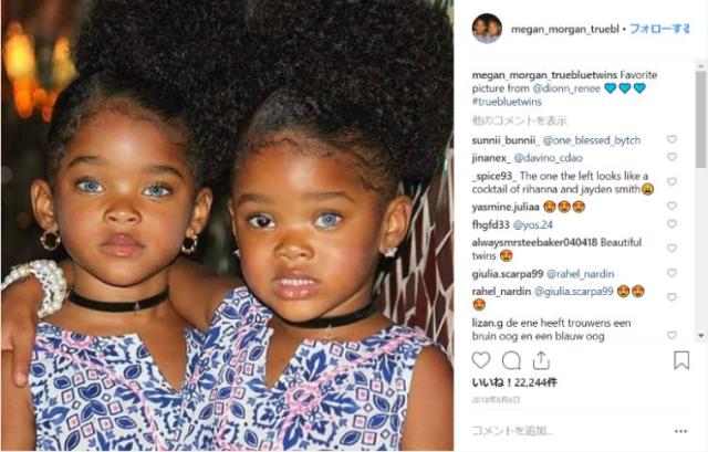 双子の姉妹の「瞳」に世界中がフォーリンラブ♡ 海のようなブルーアイズと左右で違うオッドアイの持ち主なんです